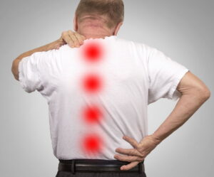 Bulging Disc in the Neck | Serious Injuries Attorney | Berenson Injury Law